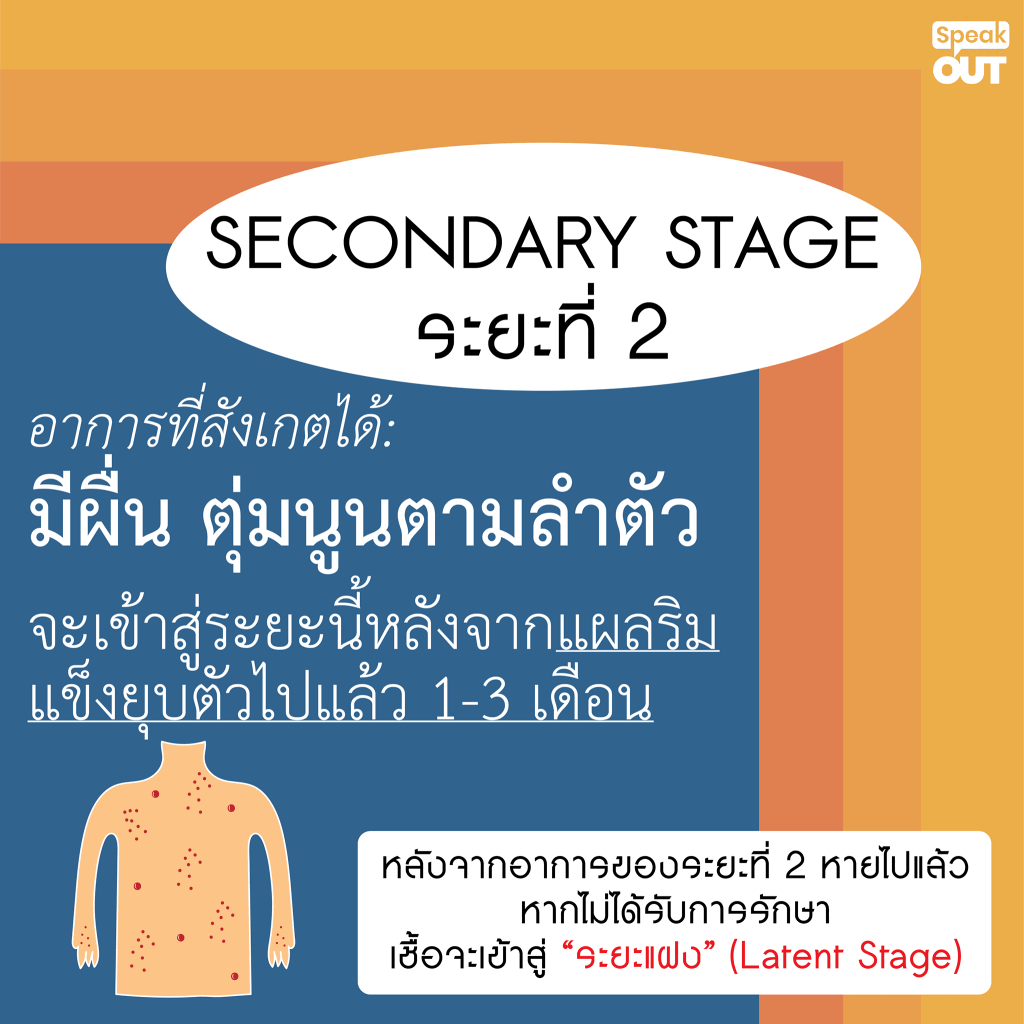 Secondary Stage