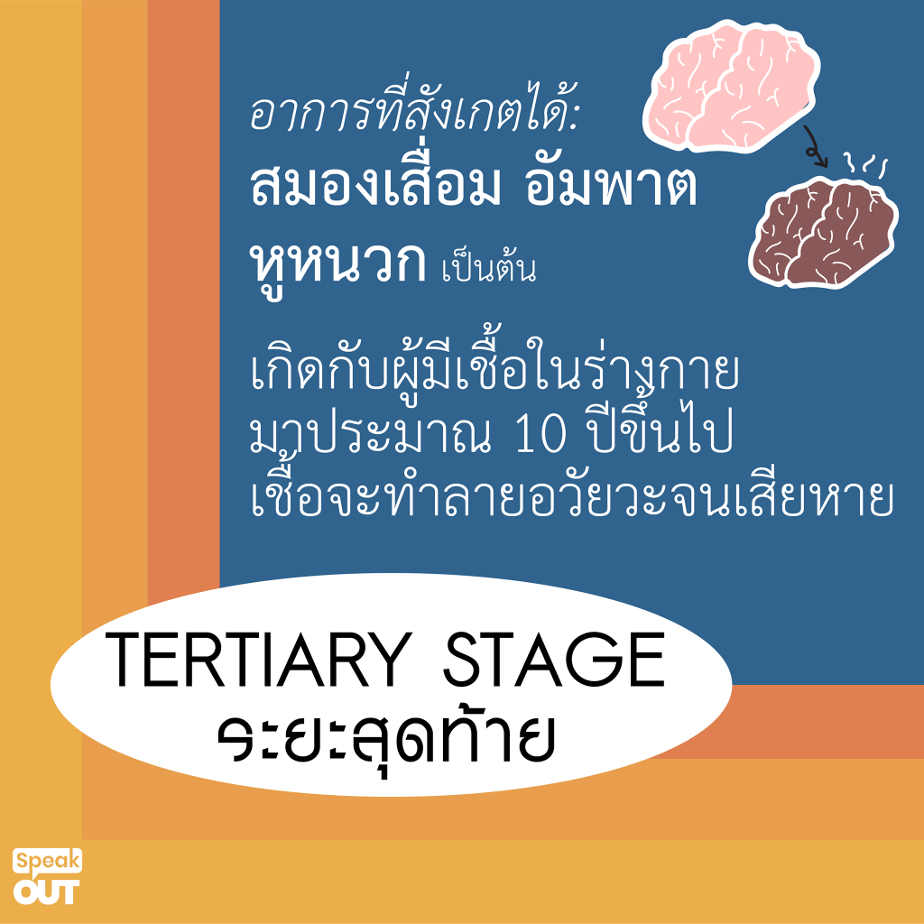 Tertiary Stage