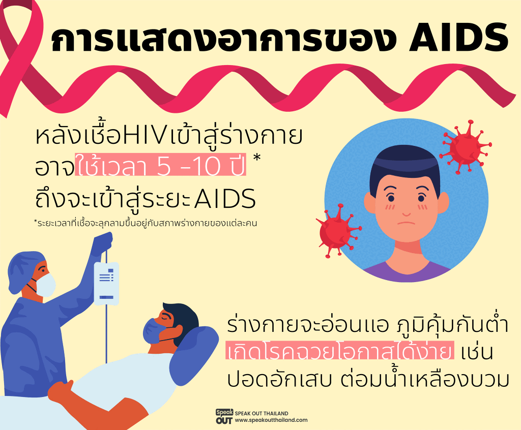 การแสดงอาการของ AIDS