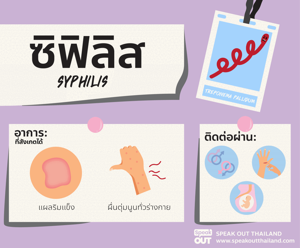 ซิฟิลิสส