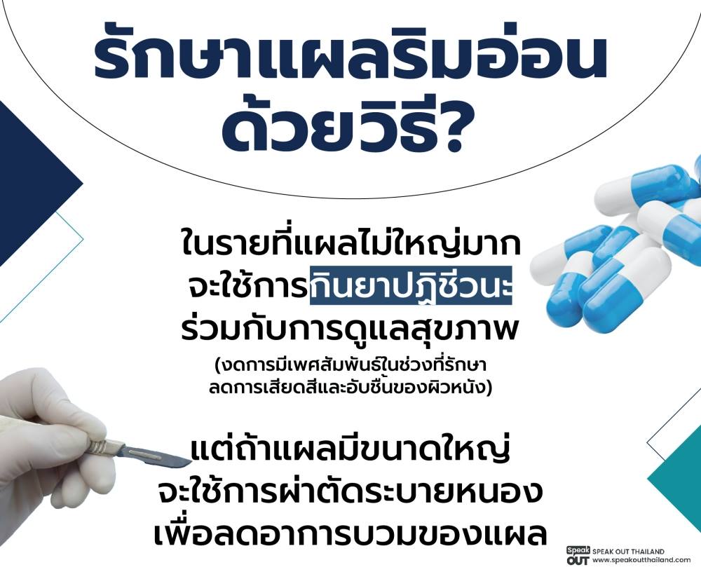 รักษาแผลริมอ่อนได้ด้วยวิธีนี้