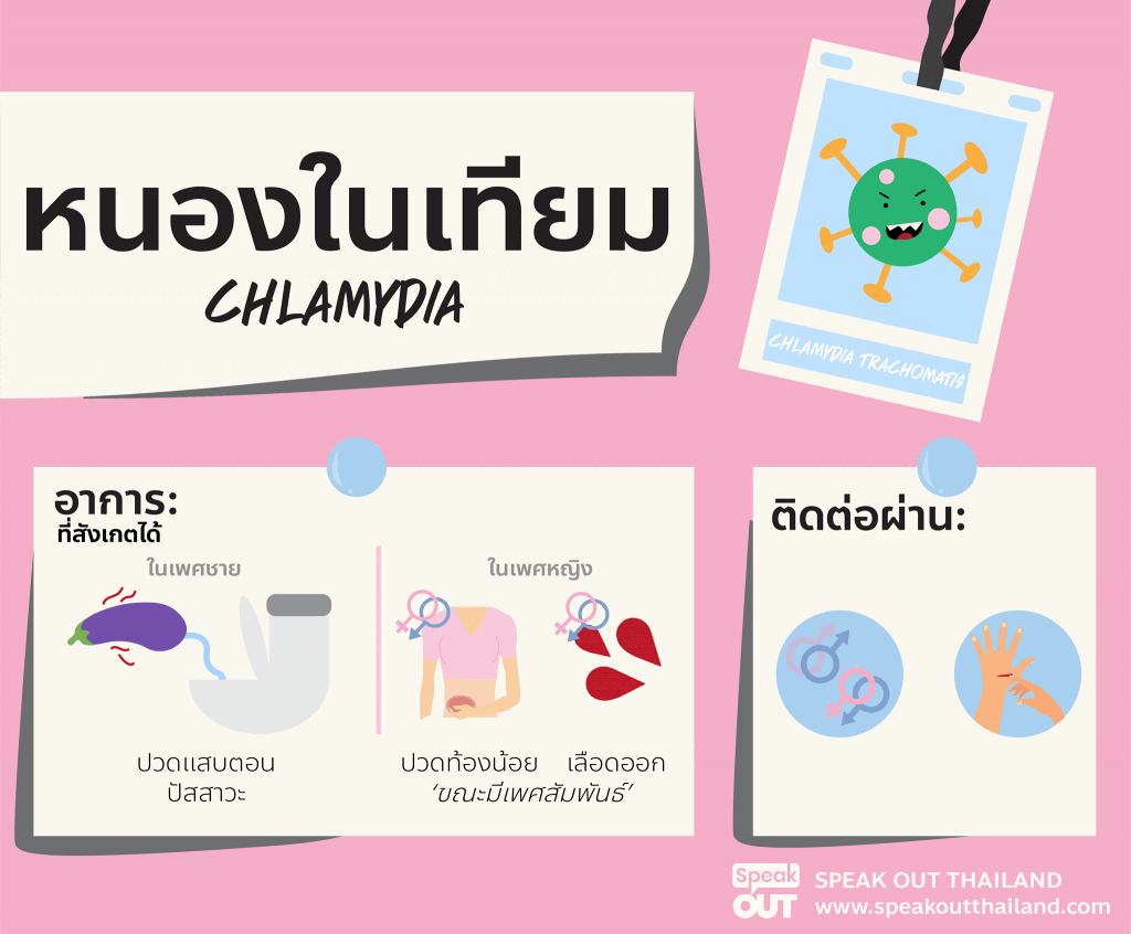 หนองในเทียม