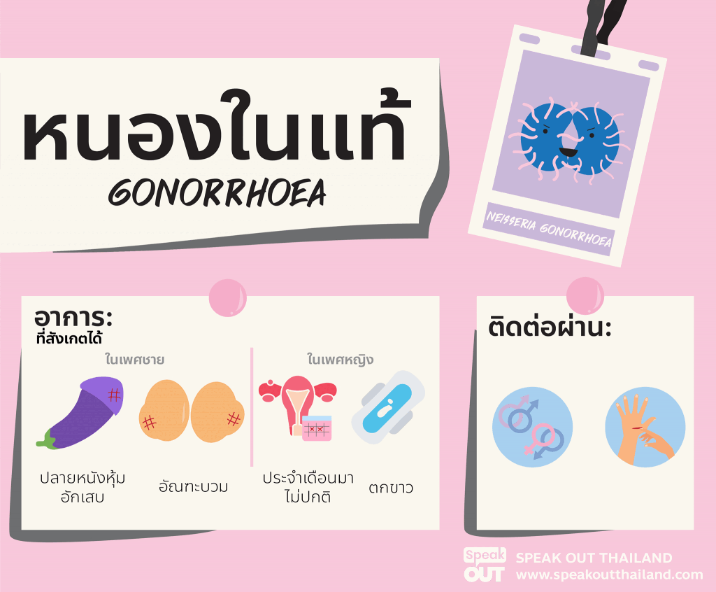 หนองในแท้