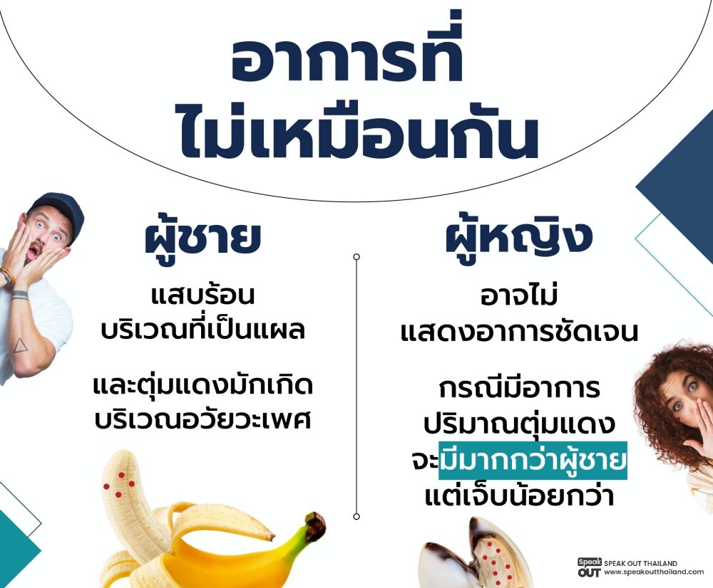 อาการในผู้ชายและผู้หญิงที่ไม่เหมือนกัน