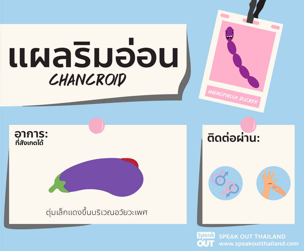 แผลริมอ่อน
